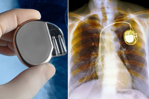 Why And When Someone Requires a Pacemaker by Best Cardiologist Doctor In Delhi